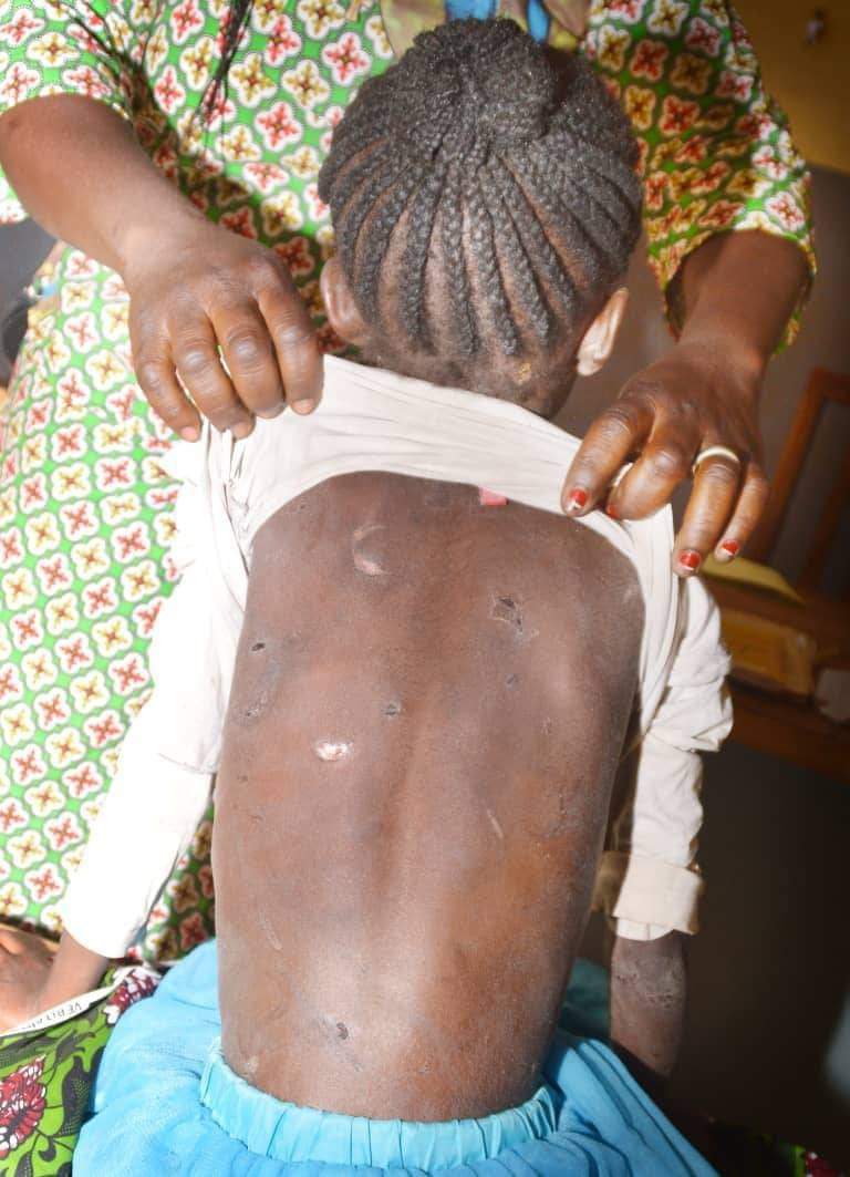 Ouagadougou : Une fillette de huit ans victime d’abus physique récupérée par la Police municipale