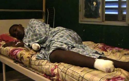 Premières images des victimes d’amputations dans le Nord-Mali