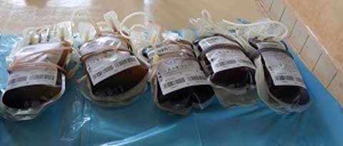 Activité de don de sang : L’association SOS sang va vers les donneurs à Yalgado 