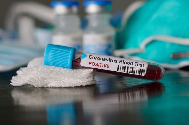Coronavirus au Burkina : le CDP interpelle le gouvernement à prendre des mesures idoines pour lutter contre la maladie
