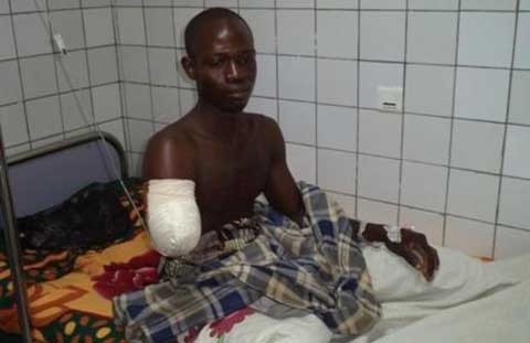 Accident de travail à la SN-SOSUCO : Seydou Ouédraogo perd son bras droit