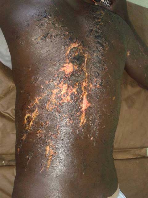 Agissements de « Kogleweogo » : Le MBDHP Kourittenga dénonce et condamne