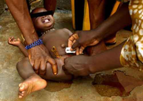 Mutilations génitales féminines : Il faut y mettre fin d’ici à 2030 selon l’UNFPA et l’UNICEF
