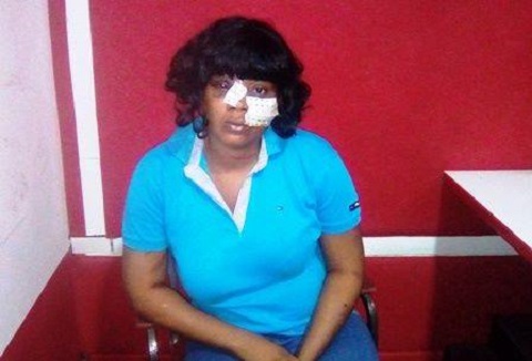 Agression de Adja Divine : Les femmes juristes invitent les autorités à punir les coupables
