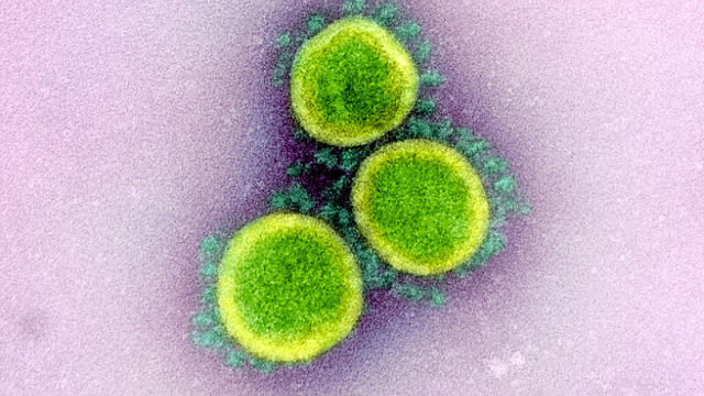 Covid-19 : Les grandes puissances s’agenouillent devant  un minuscule virus