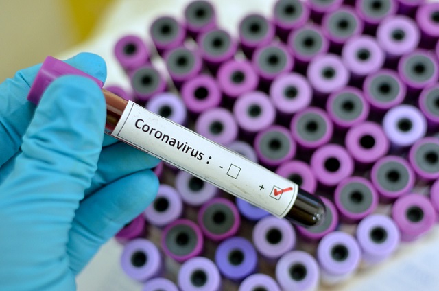  Coronavirus : Quelles sont les premières leçons qui peuvent être retenues du Covid-19 ?