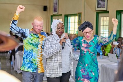 Musique : « Ma différence, mon originalité », le nouveau clip de Malika la Slamazone pour briser les discriminations liées à l’albinisme