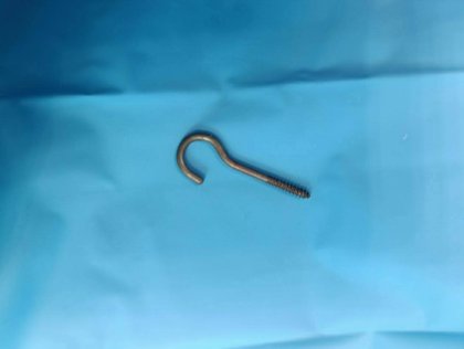 Nazinon&nbsp;: À 15 mois, elle survit après avoir avalé une pièce métallique